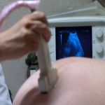 badanie prenatalne